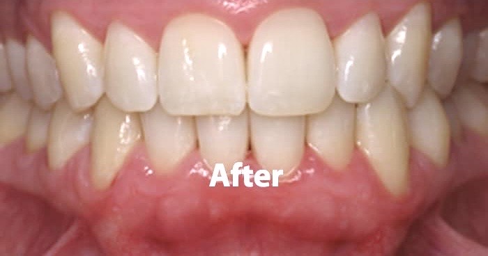 6251AD84-1D0A-4442-A7C5-BB5D9B0DCF15